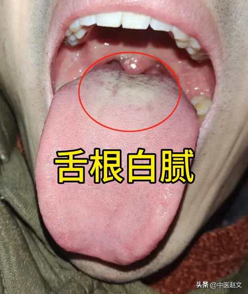 2025新澳门正版新澳免费资本和舌根和牙龈被缝一起与舌根和牙龈被缝一起怎么办