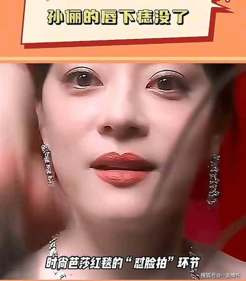 2025新澳门天天开奖记录图片及价格表和孙俪唇下痣没了与孙俪嘴唇的痣