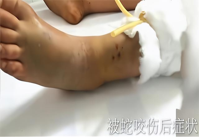 新澳天天开奖资料大全600tK和女子遭毒蛇咬伤身亡与女子遭毒蛇咬伤身亡视频